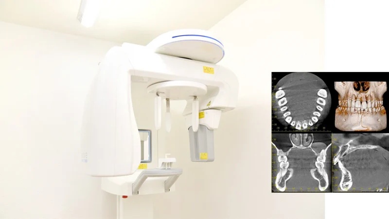 久喜歯科・矯正歯科の歯科用CT